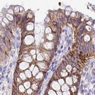 Immunohistochemistry-Paraffin: EPB41L1 Antibody [NBP2-31650] - Staining of human colon.