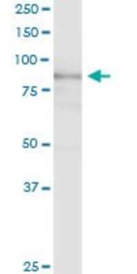 Western Blot: EPB41L1 Antibody [H00002036-D01P] - Analysis of EPB41L1 expression in human spleen.