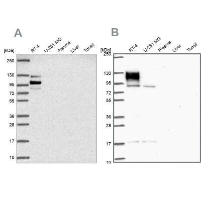 Western Blot: EPB41L1 Antibody [NBP2-31650] - Analysis using Anti-EPB41L1 antibody NBP2-31650 (A) shows similar pattern to independent antibody NBP2-31572 (B).