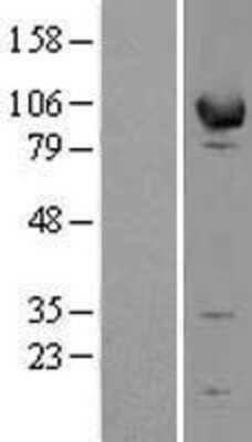 Western Blot: EPB41L1 Overexpression Lysate (Adult Normal) [NBL1-10287] Left-Empty vector transfected control cell lysate (HEK293 cell lysate); Right -Over-expression Lysate for EPB41L1.