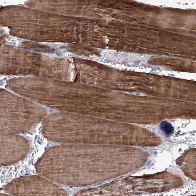 Immunohistochemistry-Paraffin: EPB41L5 Antibody [NBP2-30920] - Staining of human skeletal muscle shows strong cytoplasmic positivity in myocytes.