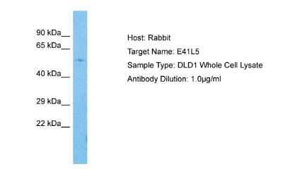 Western Blot: EPB41L5 Antibody [NBP2-87368] - Host: Rabbit. Target Name: EPB41L5. Sample Tissue: Human DLD1 Whole Cell. Antibody Dilution: 1.0ug/ml