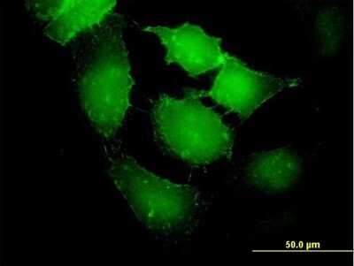 Immunocytochemistry/Immunofluorescence: EPB4IL2 Antibody [H00002037-B01P] - Analysis of purified antibody to EPB41L2 on HeLa cell. (antibody concentration 10 ug/ml)