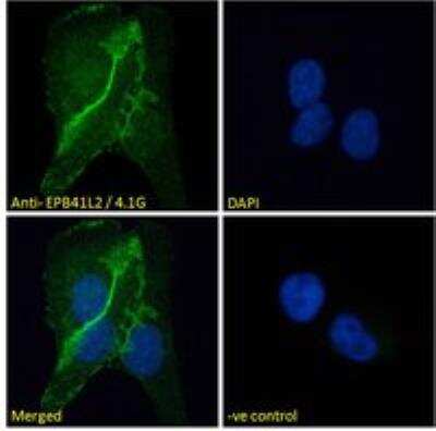 Immunocytochemistry/Immunofluorescence: EPB4IL2 Antibody [NBP1-06034] - Immunofluorescence analysis of paraformaldehyde fixed U2OS cells, permeabilized with 0.15% Triton. Primary incubation 1hr (10 ug/mL) followed by Alexa Fluor 488 secondary antibody (2 ug/mL), showing cell junction staining. The nuclear stain is DAPI (blue). Negative control: Unimmunized goat IgG (10 ug/mL) followed by Alexa Fluor 488 secondary antibody (2 ug/mL).