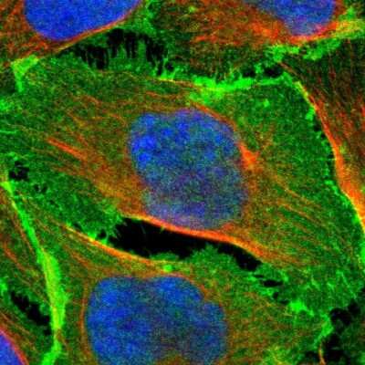 Immunocytochemistry/Immunofluorescence: EPB4IL2 Antibody [NBP1-90326] - Immunofluorescent staining of human cell line U-2 OS shows localization to plasma membrane & cell junctions.