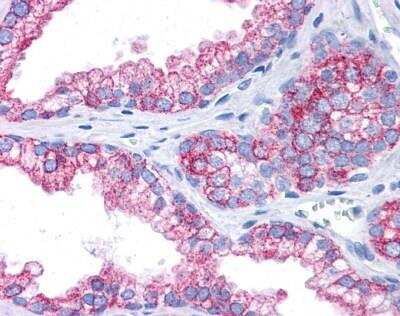 Immunohistochemistry-Paraffin: EPB4IL2 Antibody [NBP1-56763] - Human Prostate, 5 ug/ml.