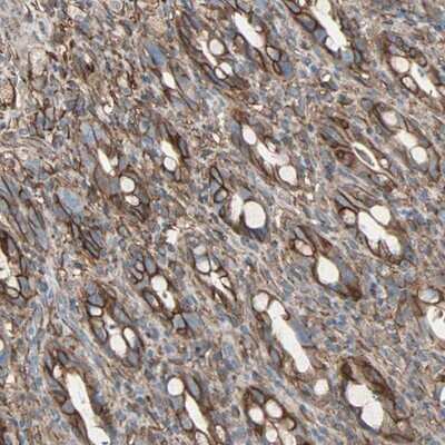 Immunohistochemistry-Paraffin: EPB4IL2 Antibody [NBP1-90325] - Staining of human rectum shows strong membranous and cytoplasmic positivity in glandular cells.