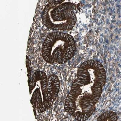 Immunohistochemistry-Paraffin: EPB4IL2 Antibody [NBP1-90326] - Staining of human corpus, uterine shows strong cytoplasmic and membranous positivity in glandular cells.