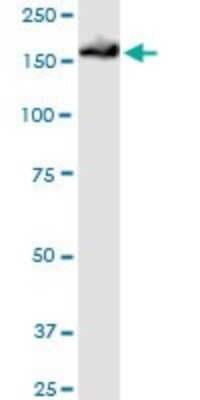 Western Blot: EPB4IL2 Antibody [H00002037-B01P] - Analysis of EPB41L2 expression in NIH/3T3.