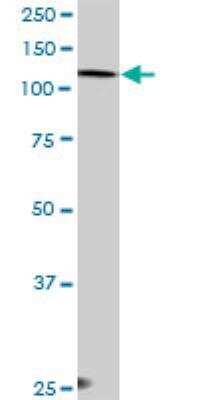 Western Blot: EPB4IL2 Antibody [H00002037-D01P] - EPB41L2 MaxPab rabbit polyclonal antibody. Western Blot analysis of EPB41L2 expression in A-431.