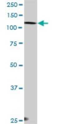 Western Blot: EPB4IL2 Antibody [H00002037-D01P] - Analysis of EPB41L2 expression in A-431.