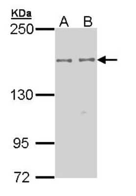 Western Blot: EPB4IL2 Antibody [NBP1-33426] - Sample (30 ug of whole cell lysate) A: Hep G2 B: Molt-4 7. 5% SDS PAGE diluted at 1:1000.