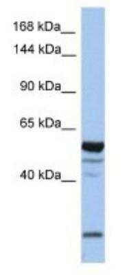 Western Blot: EPB4IL2 Antibody [NBP1-56763] - MCF-7 whole cell lysates, concentration 1 ug/ml.