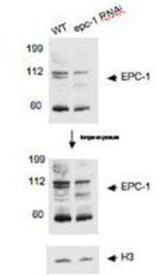 Western Blot: EPC1 Antibody [29560002] - This image is specific to animal number Q0819 Dilution: 1:10000