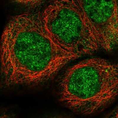 Immunocytochemistry/ Immunofluorescence EPC2 Antibody