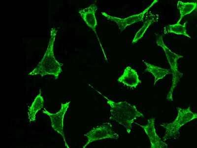 Immunocytochemistry/Immunofluorescence: EPCR Antibody (041) [NBP2-90204] - Immunofluorescence staining of PROCR in Hela cells. Cells were fixed with 4% PFA, permeabilzed with 0.1% Triton X-100 in PBS,blocked with 10% serum, and incubated with rabbit anti-Y PROCR monoclonal antibody (dilution ratio 1:60) at 4? overnight. Then cells were stained with the Alexa Fluor®488-conjugated Goat Anti-rabbit IgG secondary antibody (green). Positive staining was localized to Cytoplasm and cell membrane.