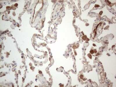 Immunohistochemistry: EPCR Antibody (12H5) [NBP2-45395] - Analysis of Human lung tissue. (Heat-induced epitope retrieval by 1mM EDTA in 10mM Tris buffer (pH8.5) at 120C for 3 min)