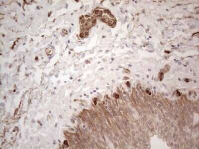 Immunohistochemistry: EPCR Antibody (12H5) [NBP2-45395] - Analysis of Human bladder tissue. (Heat-induced epitope retrieval by 1mM EDTA in 10mM Tris buffer (pH8.5) at 120C for 3 min)(1:150)