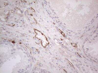 Immunohistochemistry-Paraffin: EPCR Antibody (12H5) [NBP2-45395] - Human prostate tissue within the normal limits using anti-PROCR mouse monoclonal antibody. (Heat-induced epitope retrieval by 1mM EDTA in 10mM Tris buffer (pH8.5)