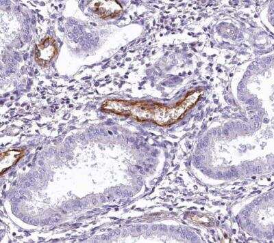 Immunohistochemistry-Paraffin: EPCR Antibody [NBP1-88168] - Staining of human endometrium shows strong cytoplasmic positivity in endothelial cells.