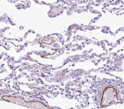 Immunohistochemistry-Paraffin: EPCR Antibody [NBP1-88168] - Staining of human lung shows strong cytoplasmic positivity in endothelial cells.