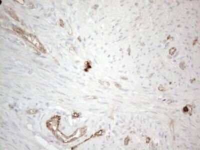 Immunohistochemistry: EPCR Antibody (OTI12H5) - Azide and BSA Free [NBP2-71607] - Analysis of Human endometrium tissue. (Heat-induced epitope retrieval by 1mM EDTA in 10mM Tris buffer (pH8.5) at 120C for 3 min)(1:150)