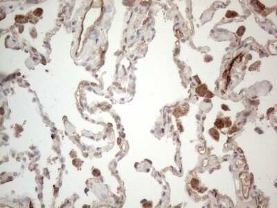 Immunohistochemistry: EPCR Antibody (OTI12H5) - Azide and BSA Free [NBP2-71607] - Analysis of Human lung tissue. (Heat-induced epitope retrieval by 1mM EDTA in 10mM Tris buffer (pH8.5) at 120C for 3 min)