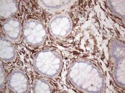 Immunohistochemistry: EPCR Antibody (OTI12H5) - Azide and BSA Free [NBP2-71607] - Human colon tissue within the normal limits using anti PROCR mouse monoclonal antibody. (Heat-induced epitope retrieval by 1mM EDTA in 10mM Tris buffer (pH8.5)