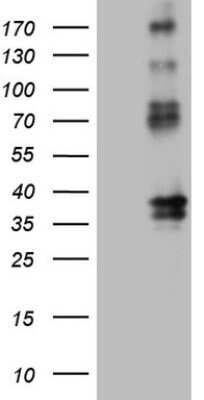 Western Blot: EPCR Antibody (OTI12H5) - Azide and BSA Free [NBP2-71607] - Analysis of HEK293T cells were transfected with the pCMV6-ENTRY control (Left lane) or pCMV6-ENTRY EPCR.