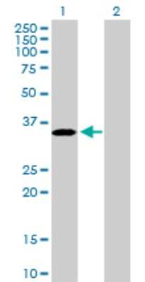 Western Blot: EPCR Antibody [H00010544-D01P] - Analysis of PROCR expression in transfected 293T cell line by PROCR polyclonal antibody.Lane 1: PROCR transfected lysate(26.70 KDa).Lane 2: Non-transfected lysate.