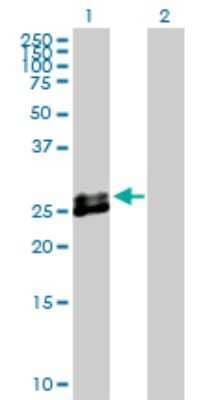 Western Blot: EPDR1 Antibody [H00054749-D01P] - Analysis of EPDR1 expression in transfected 293T cell line by EPDR1 polyclonal antibody.Lane 1: EPDR1 transfected lysate(25.40 KDa).Lane 2: Non-transfected lysate.