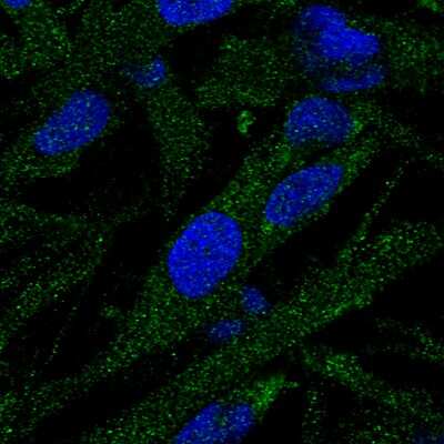 Immunocytochemistry/ Immunofluorescence EPG5 Antibody - BSA Free