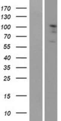 Western Blot: EPH Receptor A2 Overexpression Lysate (Adult Normal) [NBP2-10583] Left-Empty vector transfected control cell lysate (HEK293 cell lysate); Right -Over-expression Lysate for EPH Receptor A2.