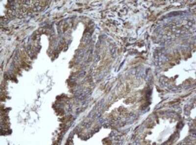 Immunohistochemistry: EPHX1 Antibody (3F10) [NBP2-45478] - Analysis of Human prostate tissue.