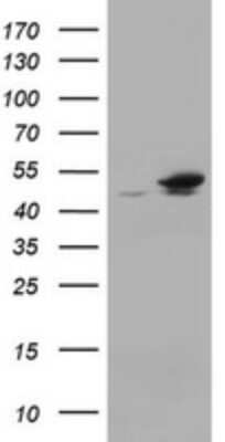 Western Blot: EPHX1 Antibody (3F10) [NBP2-45478] - Analysis of HEK293T cells were transfected with the pCMV6-ENTRY control (Left lane) or pCMV6-ENTRY EPHX1.