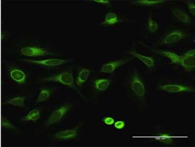 Immunocytochemistry/Immunofluorescence: EPHX1 Antibody [H00002052-D01P] - Analysis of antibody to EPHX1 on HeLa cell. Antibody concentration 10 ug/ml.