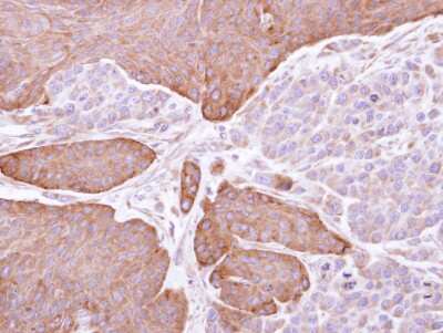 Immunohistochemistry-Paraffin: EPHX1 Antibody [NBP1-32882] - Paraffin-embedded SG xenograft, using antibody at 1:100 dilution.