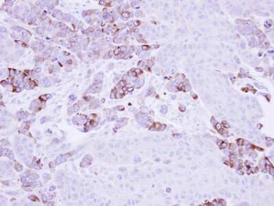 Immunohistochemistry-Paraffin: EPHX1 Antibody [NBP1-33011] - SG xenograft, using Epoxide hydrolase 1  antibody at 1:500 dilution.  Antigen Retrieval: Trilogy™ (EDTA based, pH 8.0) buffer, 15min.