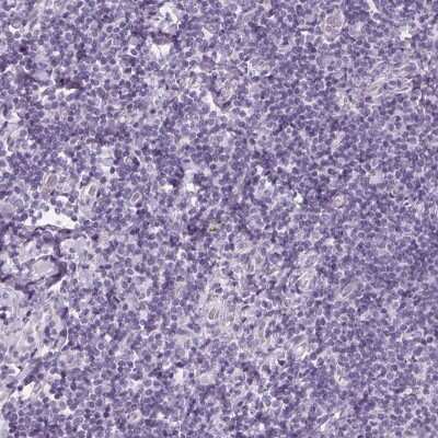 Immunohistochemistry-Paraffin: EPHX1 Antibody [NBP2-38594] - Staining of human tonsil shows low expression as expected.