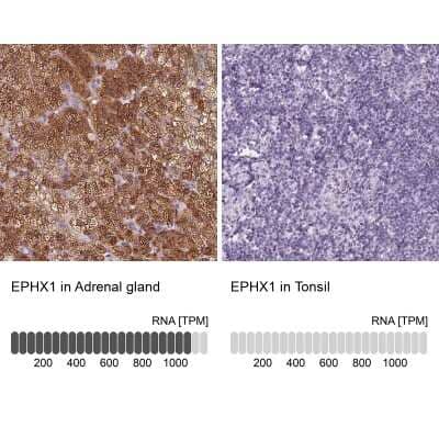 Immunohistochemistry-Paraffin: EPHX1 Antibody [NBP2-38594] - Staining in human adrenal gland and tonsil tissues using anti-EPHX1 antibody. Corresponding EPHX1 RNA-seq data are presented for the same tissues.