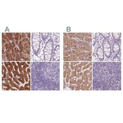 <b>Independent Antibodies Validation and Orthogonal Strategies Validation.</b>Immunohistochemistry-Paraffin: EPHX1 Antibody [NBP2-38594] - Staining of human adrenal gland, colon, liver and lymph node using Anti-EPHX1 antibody NBP2-38594 (A) shows similar protein distribution across tissues to independent antibody NBP1-83969 (B).