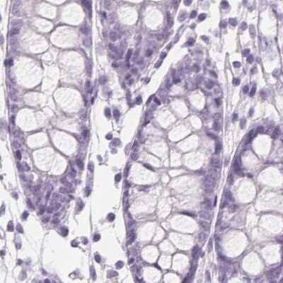 Immunohistochemistry-Paraffin: EPHX1 Antibody [NBP2-38594] - Staining of human colon.