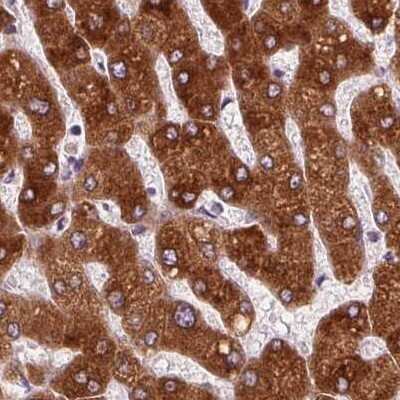 Immunohistochemistry-Paraffin: EPHX1 Antibody [NBP2-38594] - Staining of human liver.