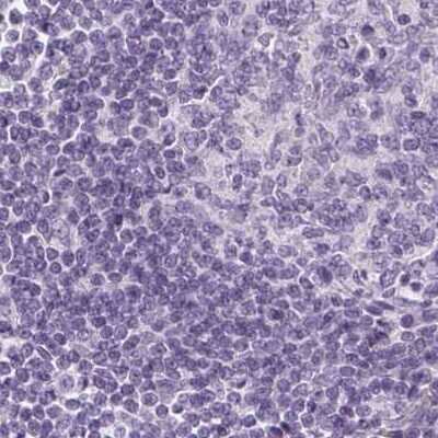 Immunohistochemistry-Paraffin: EPHX1 Antibody [NBP2-38594] - Staining of human lymph node.