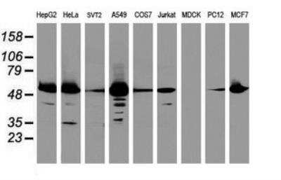 Western Blot: EPHX1 Antibody (OTI3F10) [NBP2-45478] - EPHX1 Antibody (3F10) [NBP2-45478] - Analysis of extracts (35ug) from 9 different cell lines (HepG2: human; HeLa: human; SVT2: mouse; A549: human; COS7: monkey; Jurkat: human; MDCK: canine; PC12: rat; MCF7: human).