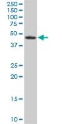 Western Blot: EPHX1 Antibody [H00002052-B01P] - Analysis of EPHX1 expression in human liver.