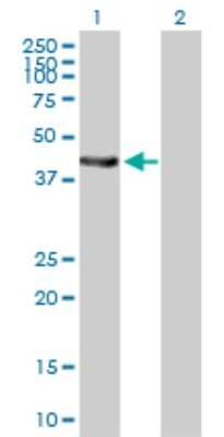 Western Blot: EPHX1 Antibody [H00002052-B01P] - Analysis of EPHX1 expression in transfected 293T cell line by EPHX1 polyclonal antibody.  Lane 1: EPHX1 transfected lysate(50.05 KDa). Lane 2: Non-transfected lysate.