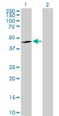 Western Blot: EPHX1 Antibody [H00002052-D01P] - Analysis of EPHX1 expression in transfected 293T cell line by EPHX1 polyclonal antibody.Lane 1: EPHX1 transfected lysate(52.90 KDa).Lane 2: Non-transfected lysate.