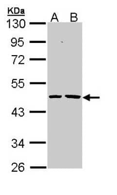 Western Blot: EPHX1 Antibody [NBP1-32882] - Sample (30 ug of whole cell lysate) A: H1299 B: Hela 10% SDS PAGE; antibody diluted at 1:1000.