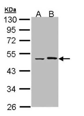 Western Blot: EPHX1 Antibody [NBP1-33011] - Sample (30 ug of whole cell lysate) A: Hela B: Hep G2 10% SDS PAGE; antibody diluted at 1:1000.